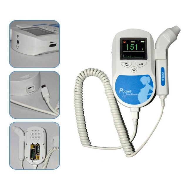 sonoline c fetal doppler